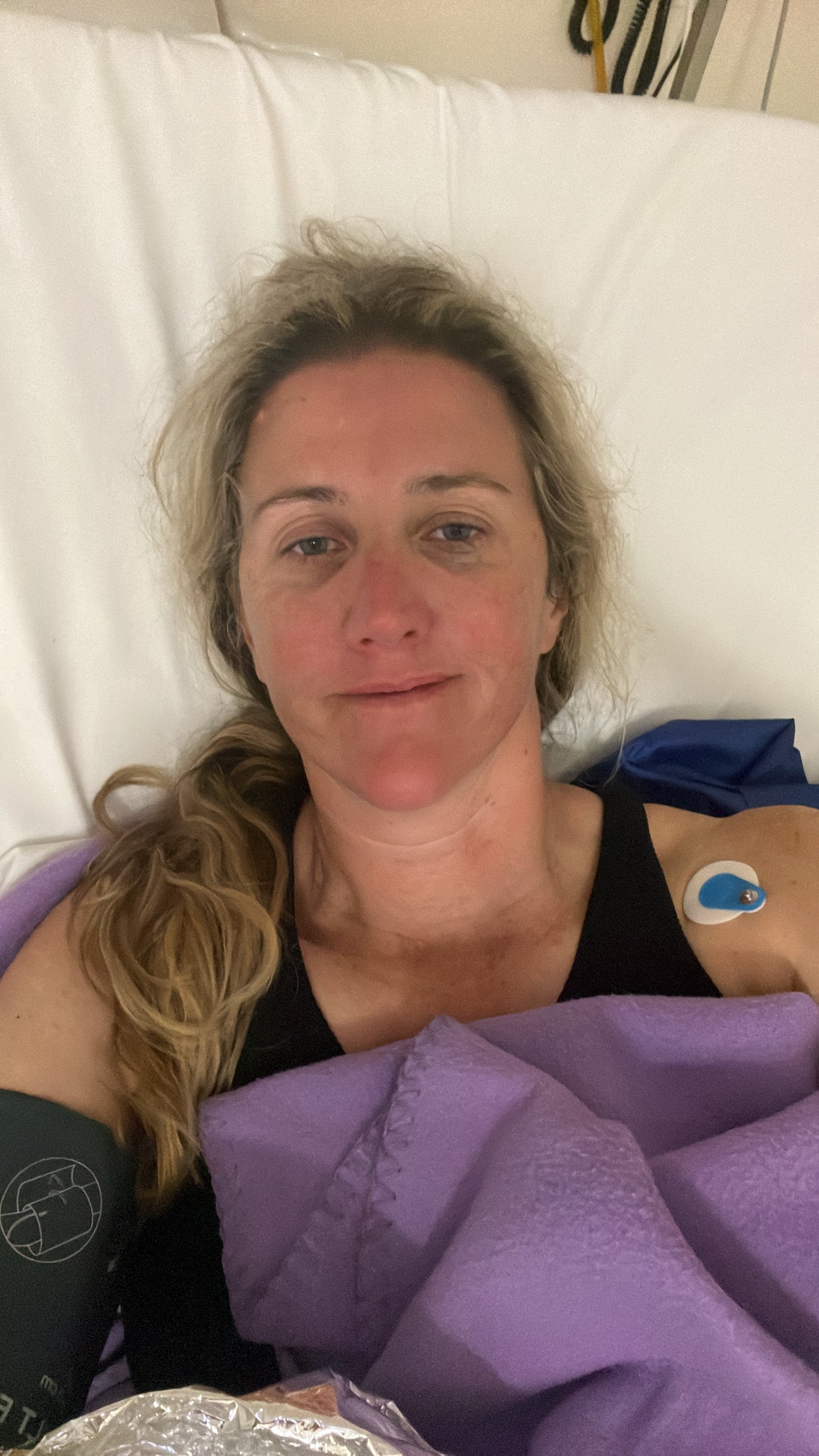 Sarah recovering